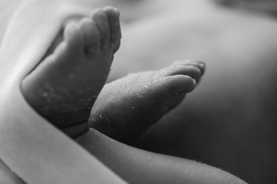 newborn feet with skin peeling